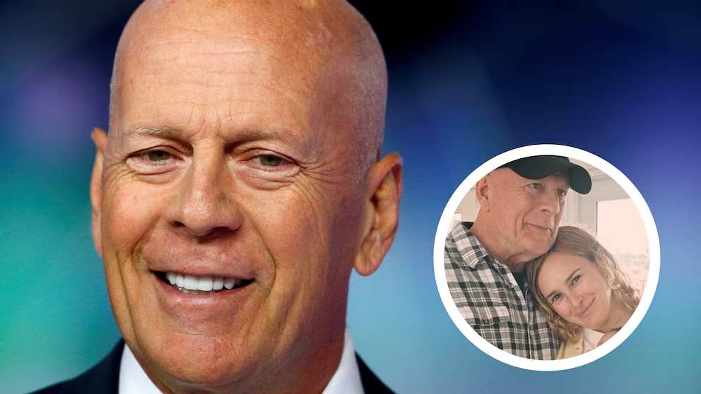 Qué es la demencia frontotemporal, la compleja patología que sufre Edgardo “el Paton” Bauza