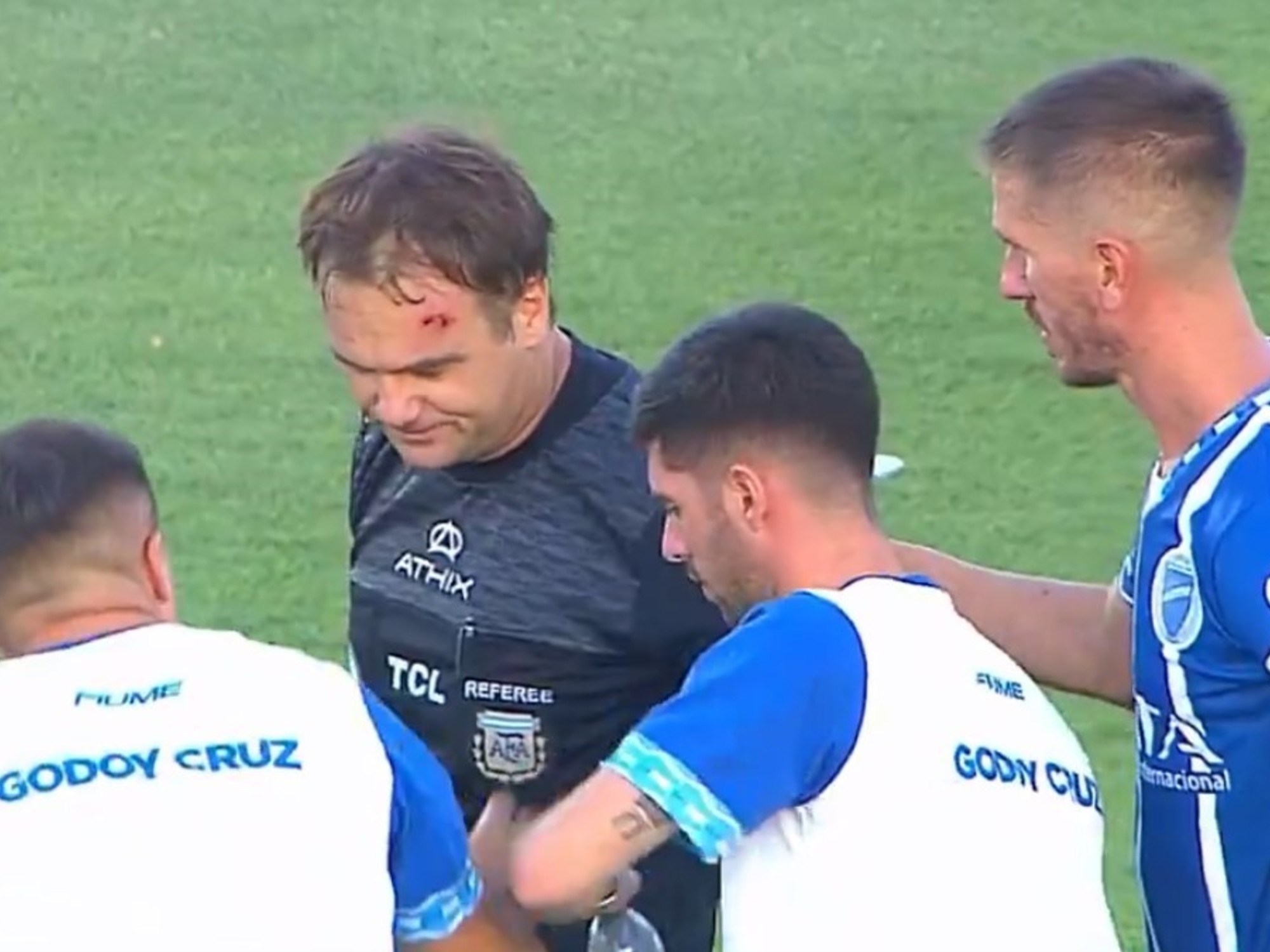 Así es el proyectil con el que agredieron al juez de línea en Godoy Cruz-Talleres: fue derivado a un hospital tras el incidente