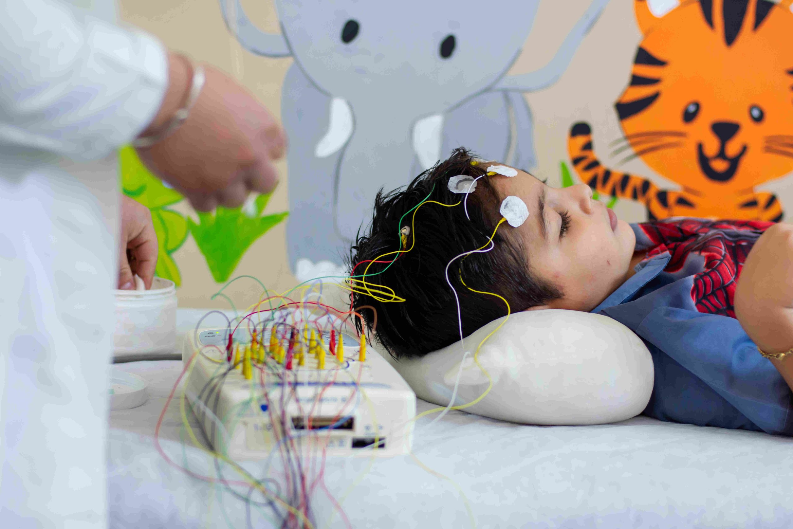 La inteligencia artificial, una nueva aliada en cirugías para tratar la epilepsia infantil