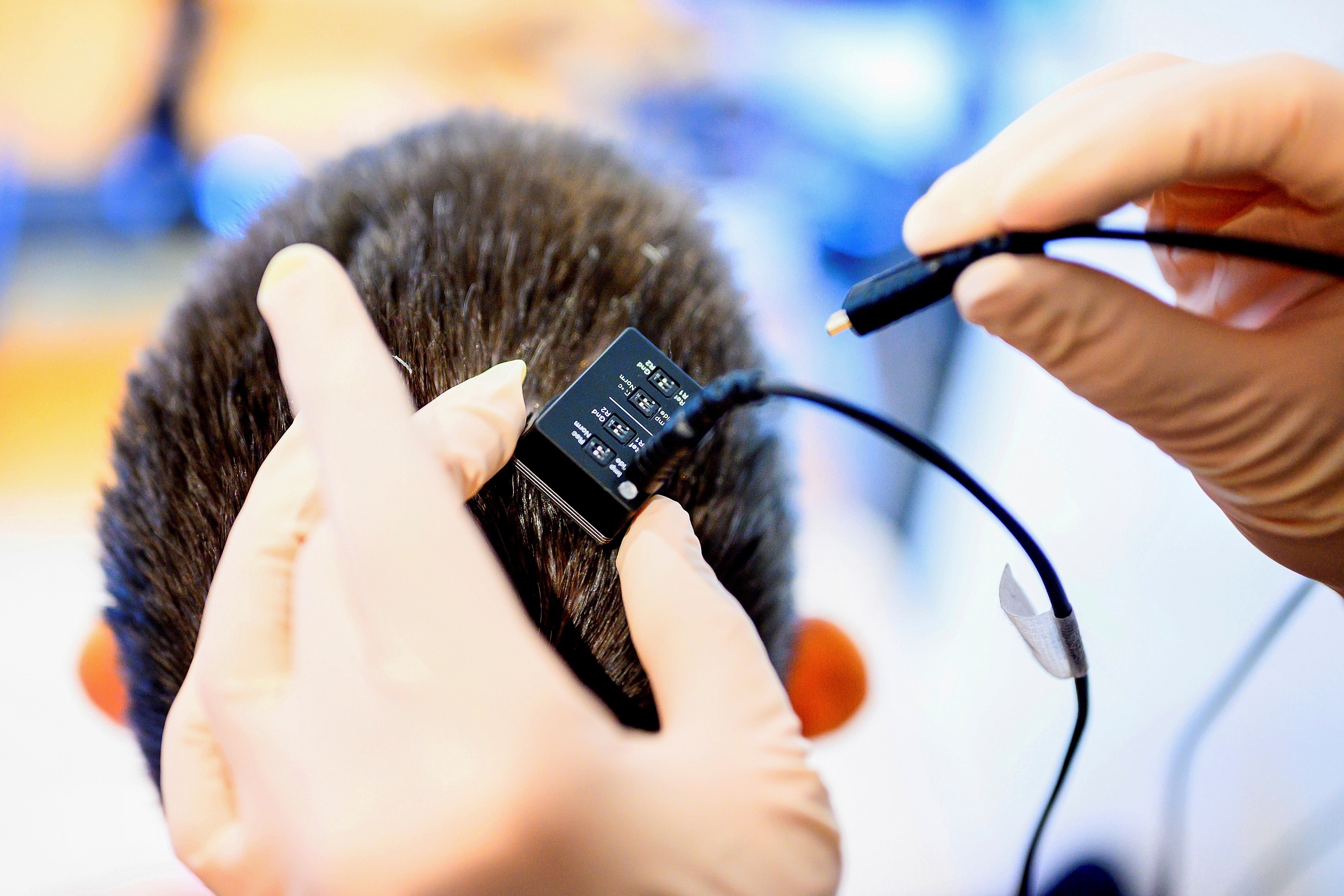 Avance Tecnológico: Mujer Recupera Habla Tras 18 Años Gracias a IA