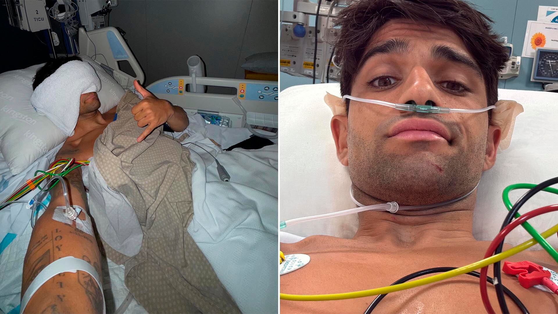 Accidente Aterrador Deja a Campeón de MotoGP con 11 Fracturas