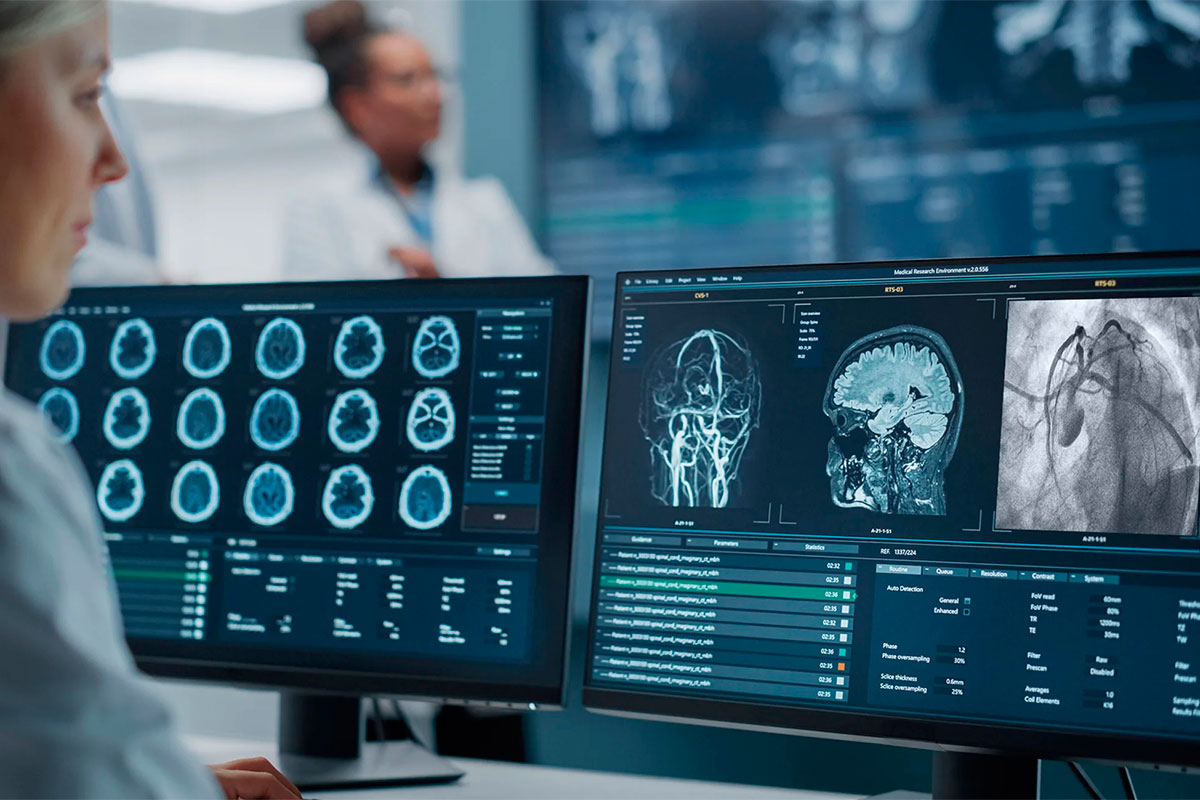 Preocupa el aumento de ACV en mujeres y adultos jóvenes a nivel mundial